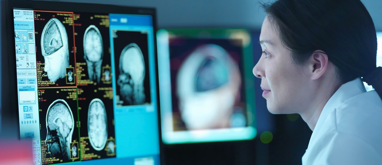 En kvinna tittar på två datorskärmar med röntgenbilder av en hjärna.