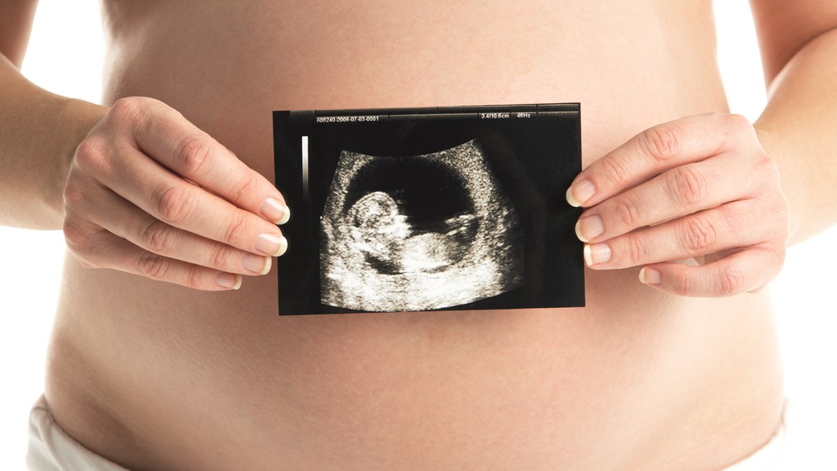En gravid kvinna håller en ultraljudsbild av sitt barn framför sin stora mage.