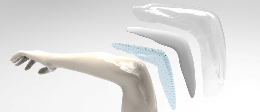 wound dressing